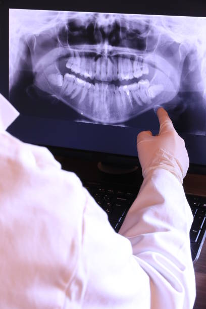 Best Emergency Treatment for Dental Infections or Abscesses in Swanton, OH