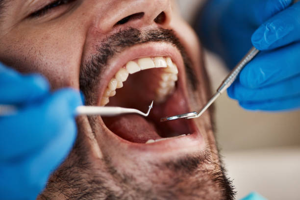 Best Urgent Care for Lost Fillings or Crowns in Swanton, OH