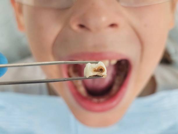 Best After-Hours Dental Trauma Care in Swanton, OH